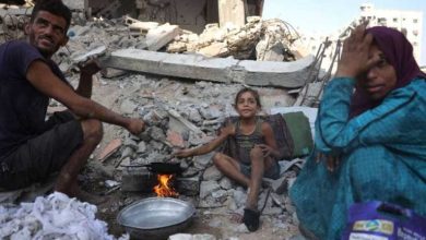 صورة بينهم 117 طفلا..التجويع الإسرائيلي يزهق أرواح 300 فلسطيني في غزة