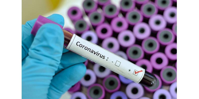 صورة تسجيل 176 حالة إصابة بفيروس كورونا و6 وفيات خلال الـ24 ساعة الأخيرة