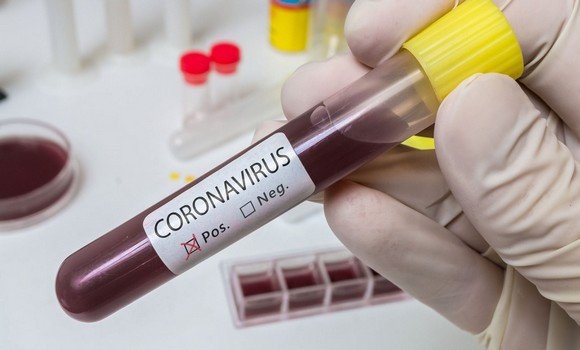 صورة فيروس كورونا:  5 إصابات جديدة مع عدم تسجيل أي وفيات في الـ 24 ساعة الأخيرة