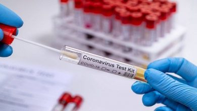 صورة فيروس كورونا:  87 إصابة جديدة، 71 حالة شفاء و وفاتان