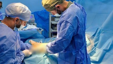 صورة البيض.. إجراء 20 عملية جراحية ضمن أيام جراحة العظام